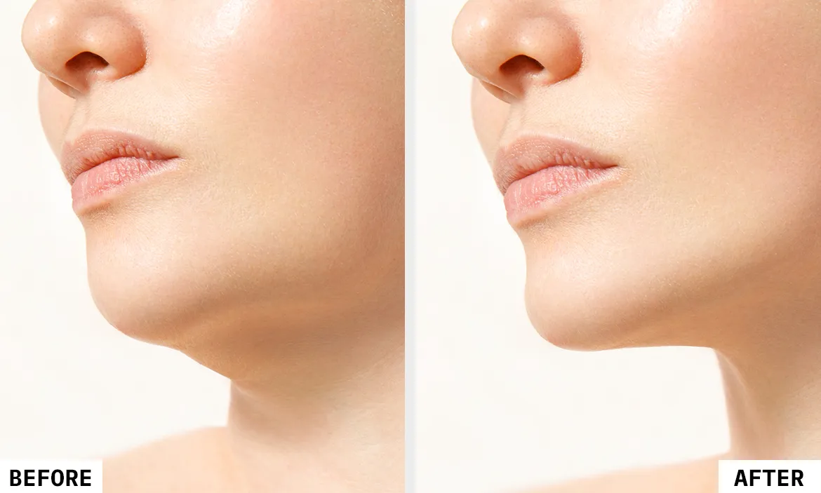 Before and After Results 2